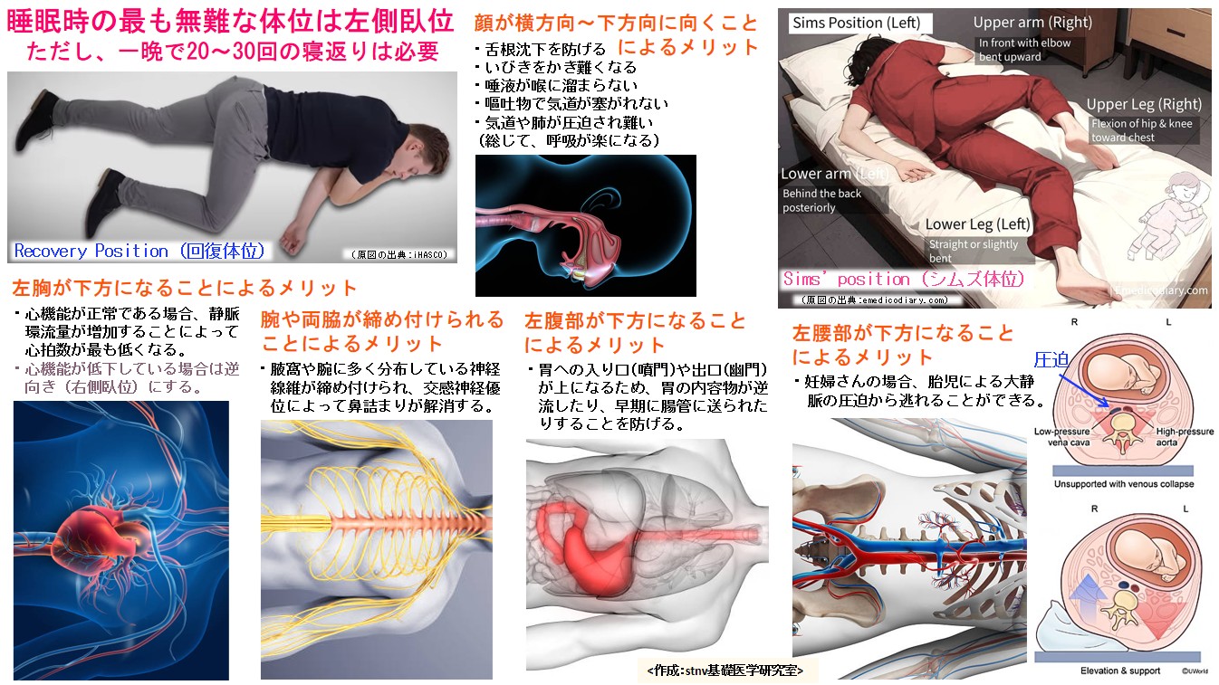 睡眠時の最も無難な体位は左側臥位