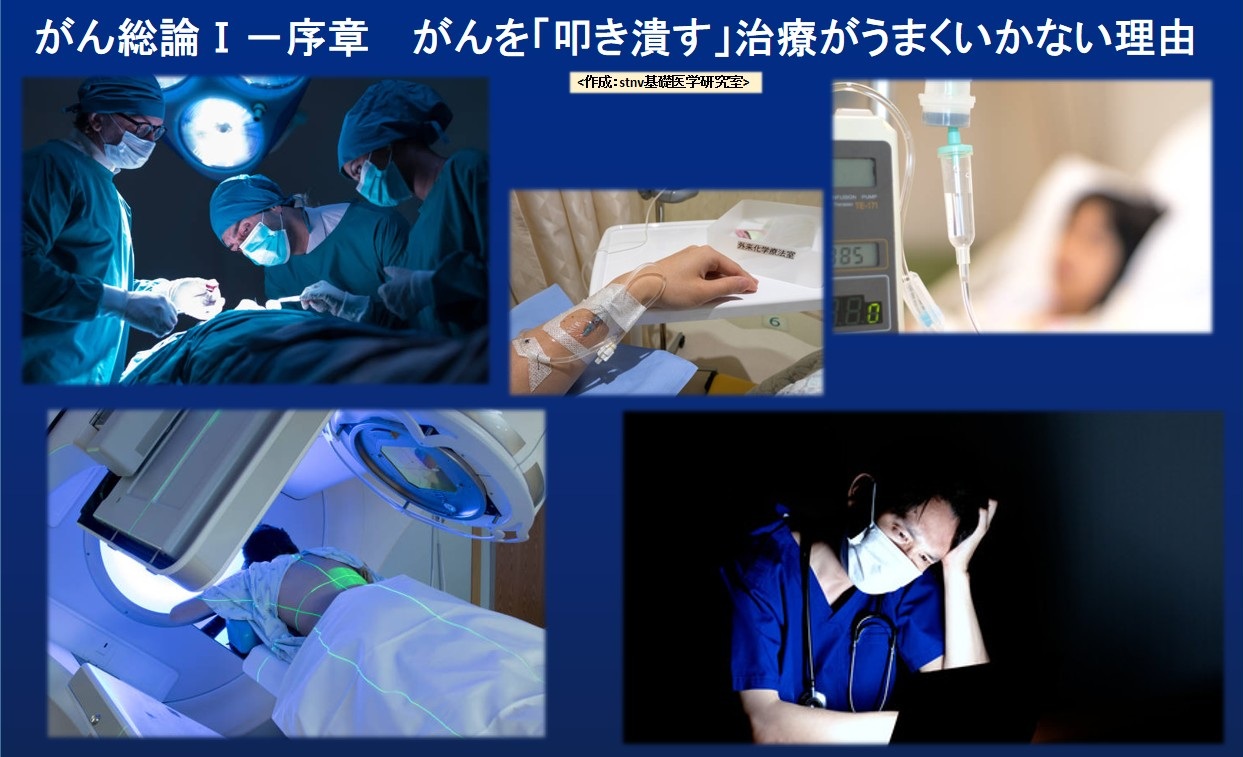 がん総論Ⅰ－序章　 がんを「叩き潰す」治療がうまくいかない理由
